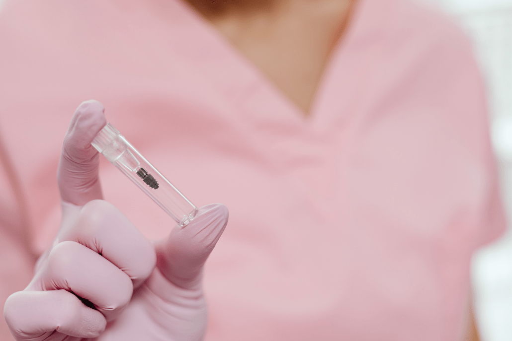muestra implante dental en gijon