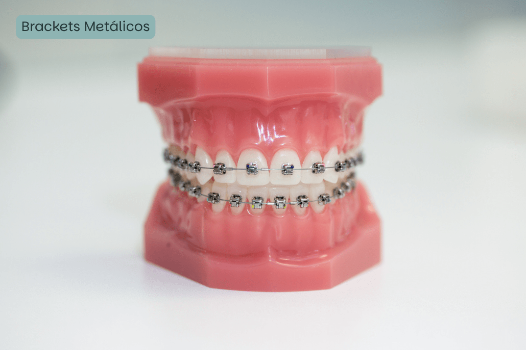 Brackets Metálicos Gijón